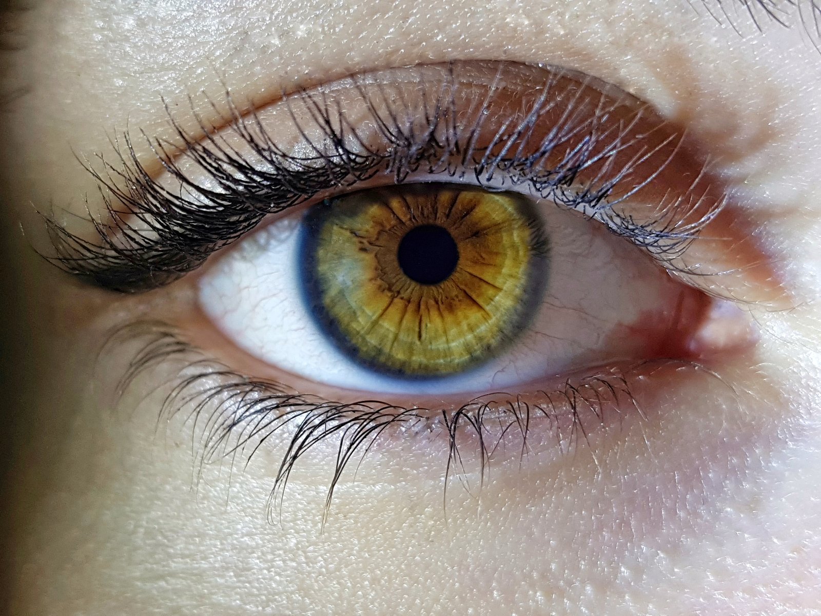 LASIK-Img